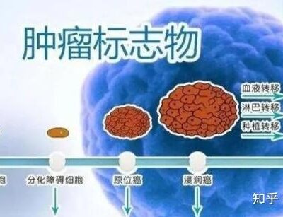肿瘤医院云化转型的机遇与挑战